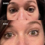 Novesya™ Lifting : Patchs Anti-Poches et Ridules Effet Immédiat