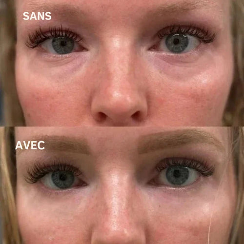 Novesya™ Lifting : Patchs Anti-Poches et Ridules Effet Immédiat