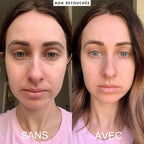 Novesya™ : 4 Masques de Collagène Ultra Rajeunissant