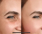 Novesya™ Lifting : Patchs Anti-Poches et Ridules Effet Immédiat