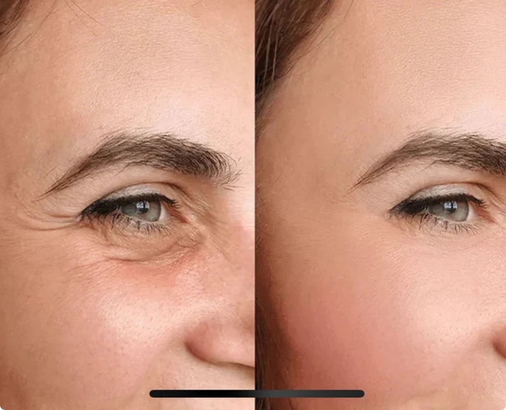 Novesya™ Lifting : Patchs Anti-Poches et Ridules Effet Immédiat