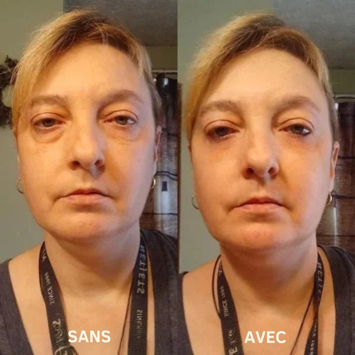 Novesya™ Lifting : Patchs Anti-Poches et Ridules Effet Immédiat