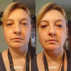 Novesya™ Lifting : Patchs Anti-Poches et Ridules Effet Immédiat