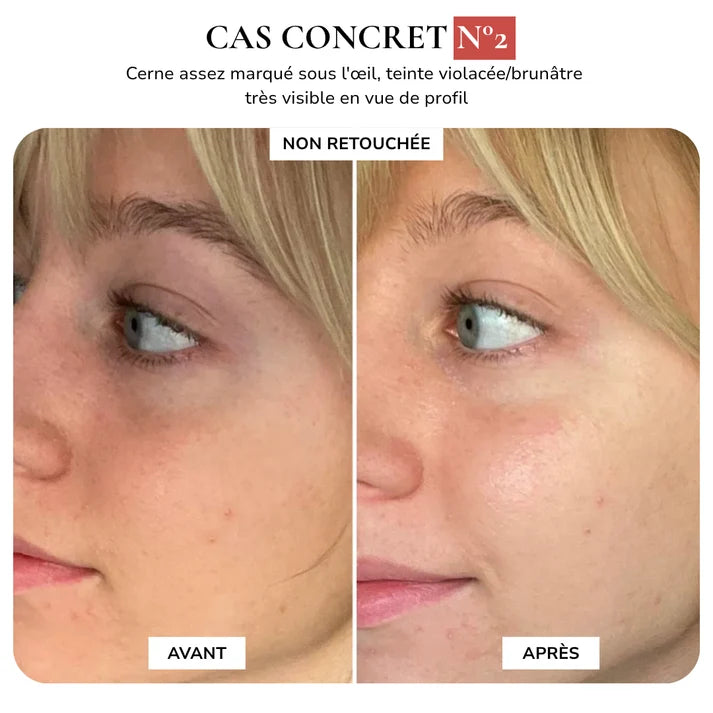 Novesya™: Anti-Cernes